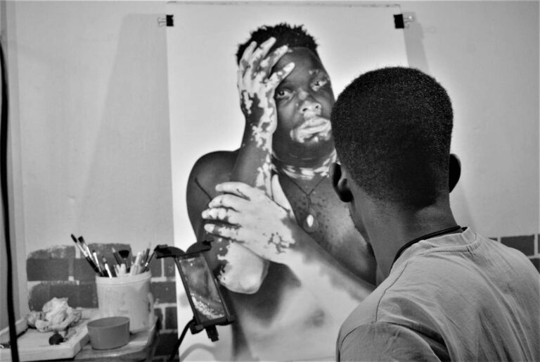 Celebrating the Work of Martin Senkubuge; the Ugandan Artist Using Art to Educate the World about Vitiligo