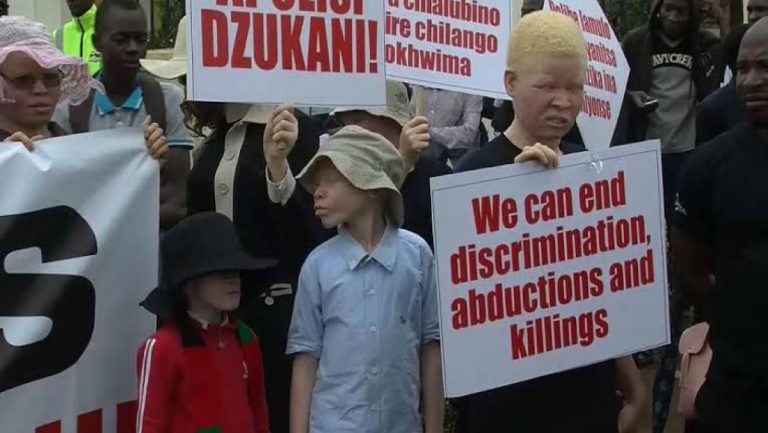 Malawian Court To Decide Fate of Albino Murderers