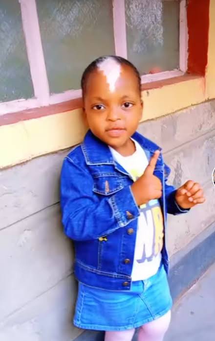 Little African Girl With Unique Shiny Birthmark And White Frontal Hairs Goes Viral